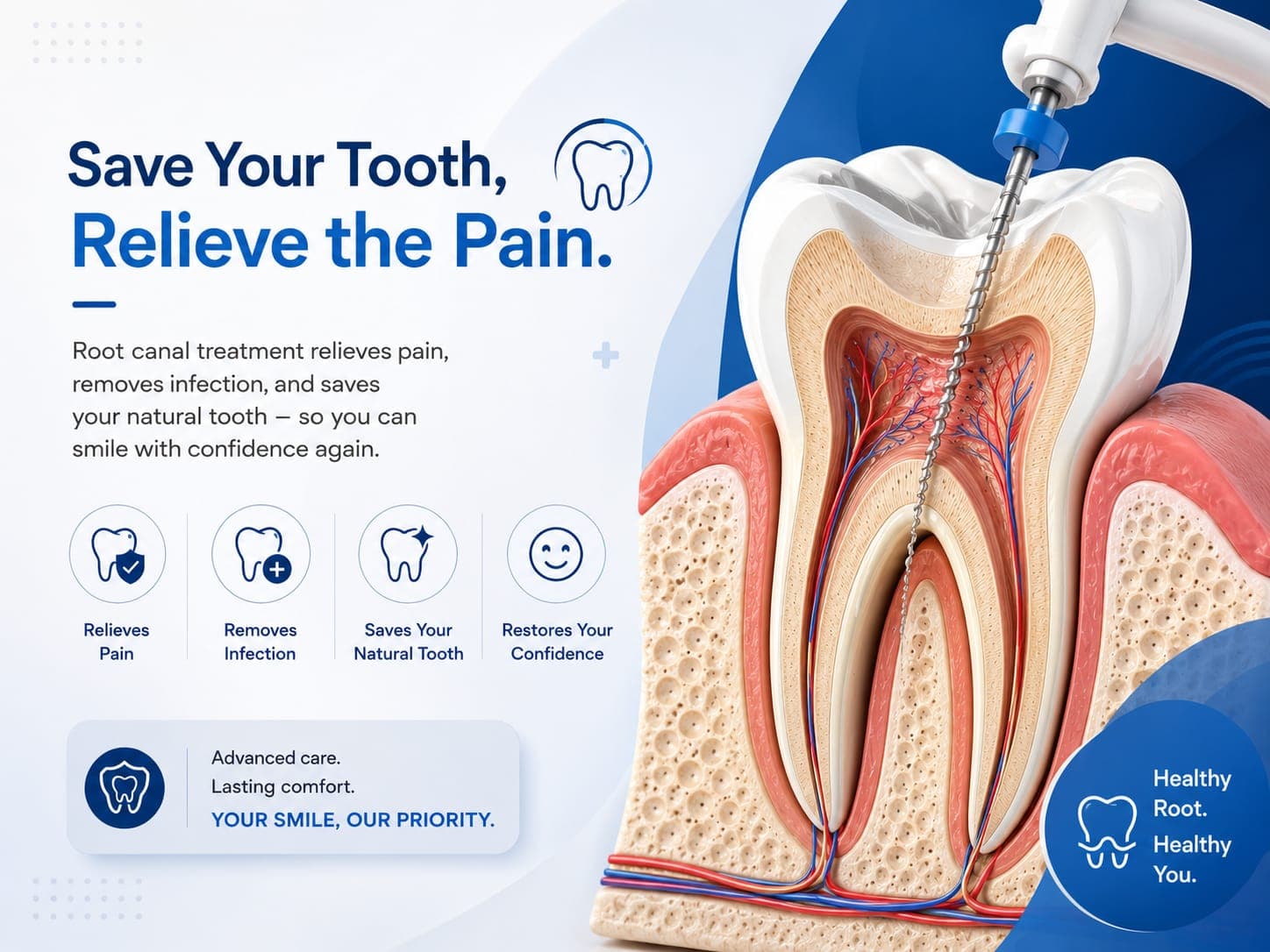 Root Canal Treatments